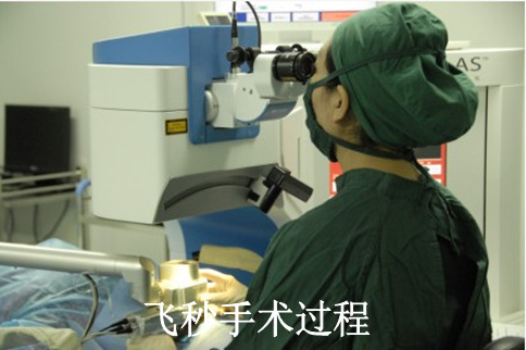 我的飞秒激光近视手术之旅