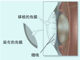 角膜