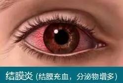 长沙爱尔眼科医院
